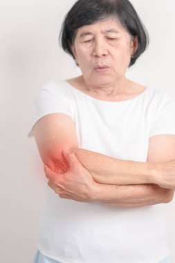 Tenis dirseği, kas ağrısı, yan epikondilit, Bursitis, yaralanma, Ofis sendromu, kıdemli sağlık ve tıbbi bakım kavramları için dirsek ağrısı çeken yaşlı bir kadın. 
