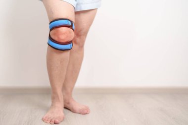 Runners Knee ya da Patellofemoral Pain Sendromu, osteoartrit, romatizma, romatizma ve Patellar Tendinitis kavramları için diz desteği desteği olan yaşlı bir kadın. Kıdemli sağlık hizmetleri 