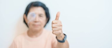 Göz ameliyatından sonra koruyucu kalkanı olan yaşlı bir kadın. Göz hastalığı, Katarakt, Glaukoma, Yaşla İlgili Maküler Dejenerasyon, Diyabetik Retinopati, Vitreous, Lasik, Dünya Glaukoma Günü ve Sağlık 