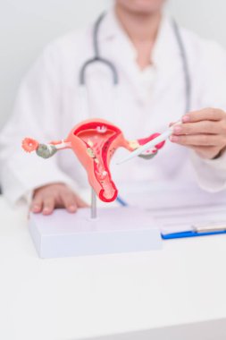 Anatomi rahim ve yumurtalıkları olan kadın hasta danışmanı. Yumurtalık ve rahim ağzı kanseri, rahim ağzı bozukluğu, endometriyozis, histerektomi, rahim fibroidi, üreme sistemi ve hamilelik konsepti.