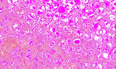 Mevsimsel, tatiller, etkinlikler ve metin veya resimleriniz için kopyalama alanı olan kutlamalar için pembe soyut arkaplan