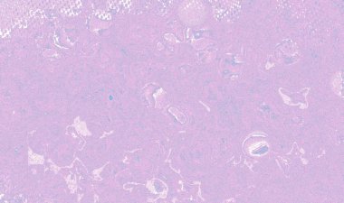 Mor soyut arkaplan pankartı, Parti için mükemmel yıldönümü, selamlar, poster, reklam, etkinlikler ve çeşitli tasarım çalışmaları.