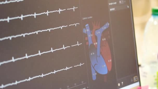 Kijów Ukraina Kwiecień 2023 Instytut Serca Monitor Pacjenta Pokazuje Dane — Wideo stockowe