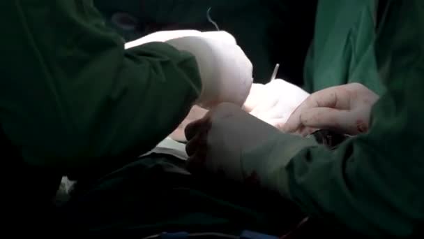 Kijów Ukraina Kwiecień 2023 Instytut Serca Chirurdzy Wykonują Operacje Serca — Wideo stockowe