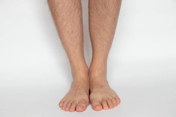 Männerbeine Auf Weißem Hintergrund Nahaufnahme Gesundheit Und Körper — Stockfoto