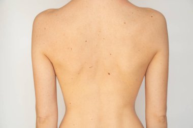 The back of a young thin girl on a white background without retouching and processing, body