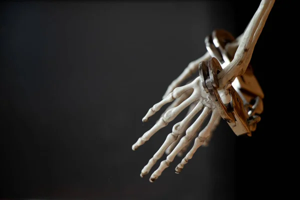 Руки Скелета Наручниках Черном Фоне — стоковое фото