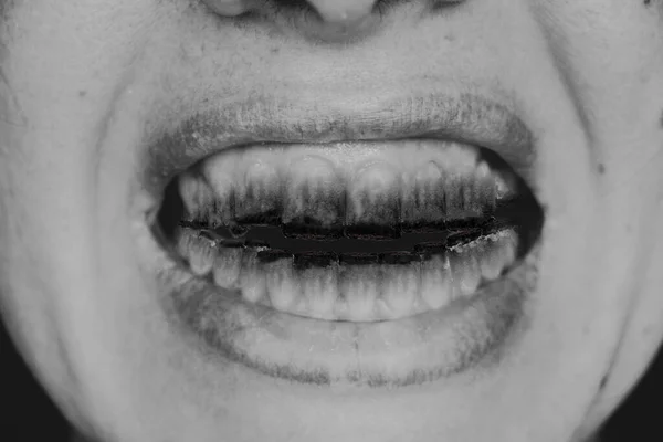 歯の代わりに黒と白の写真 歯の害ではなく 明るいタバコを持つ女の子のオープン口 — ストック写真