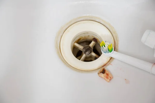 A pulled out tooth with blood lies in the bathroom sink and a toothbrush and toothpaste, dental care and teeth cleaning, dentistry, tooth extraction