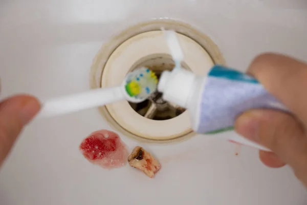 An extracted tooth with blood lies in the bathroom sink against the background of a toothbrush and toothpaste, dental care and brushing teeth, dentistry, tooth extraction
