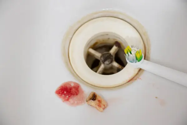 An extracted tooth with blood lies in the bathroom sink and a toothbrush, dental care and teeth cleaning, dentistry, tooth extraction