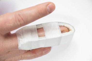 Kırık bir parmak ve kırık bir parmağa sabitlenmiş kırık bir parmak, kırık bir parmak, yaralanma, kaza, bir adam parmağını kırdı.