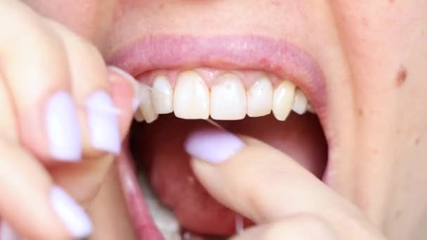 Κορίτσι Βουρτσίζει Δόντια Της Οδοντικό Νήμα Από Κοντά Οδοντιατρική Περίθαλψη — Αρχείο Βίντεο