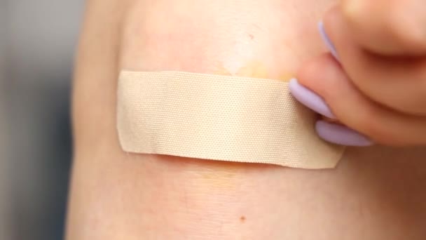 Feridas Com Sangue Joelho Uma Menina Após Uma Queda Lesão — Vídeo de Stock