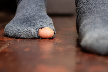 Yoksulluk ve kir içinde bir evin zemininde yırtık bir çorapla kadınların bacakları yırtık.