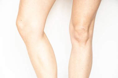 Beyaz arka planda kadın bacakları, sağlık, cilt ve tıbbi muayene teması