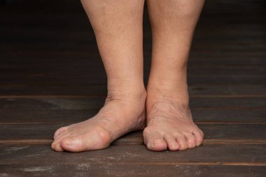 Yazın açık havada, kahverengi ahşap bir zeminde çıplak ayaklı yaşlı bir kadın. Sağlık ve açık hava eğlencesi.