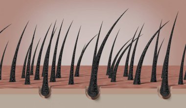 Kurumuş ve hasarlı saç kökleri - 3 boyutlu illüstrasyon