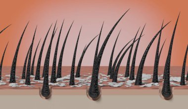 Saç kökleri ve kepek mikroskop altında - 3 boyutlu illüstrasyon