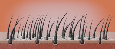 Saç kökleri ve kepek mikroskop altında - 3 boyutlu illüstrasyon