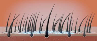 Saç kökleri ve kepek mikroskop altında - 3 boyutlu illüstrasyon