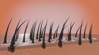 Saç kökleri ve kepek mikroskop altında - 3 boyutlu illüstrasyon