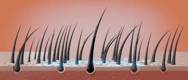 Hair follicles and dandruff under microscope - 3D illustration