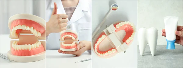 Collage Photos Teeth Treatment Concept — Stock Photo, Image
