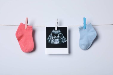 Concept of maternity, parenting, happy pregnancy period