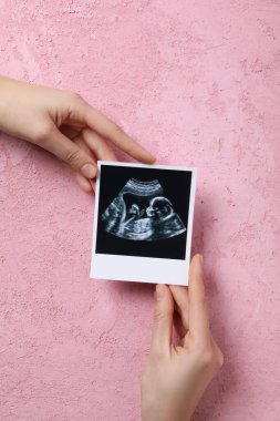 Concept of maternity, parenting and pregnancy, top view