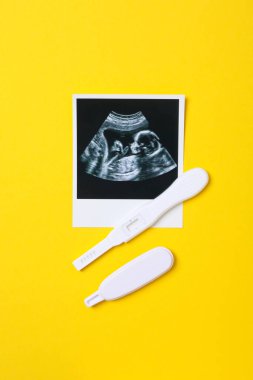 Concept of pregnancy and maternity, top view