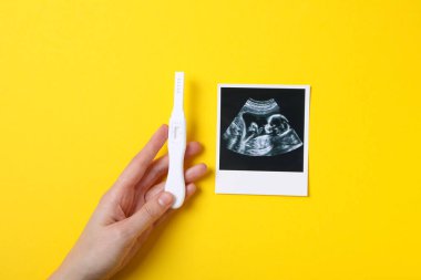 Concept of pregnancy and maternity, top view