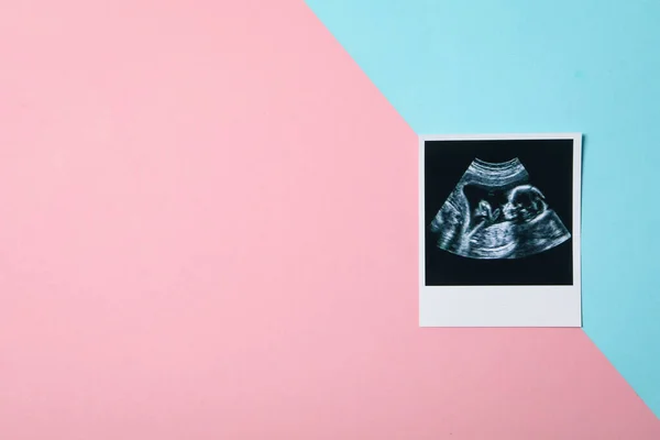 Concept Pregnancy Maternity Space Text — Foto de Stock