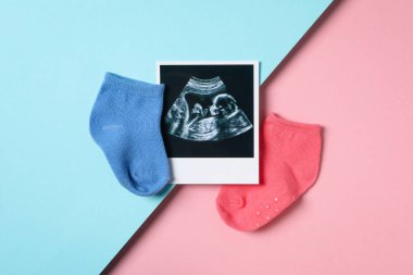 Concept of pregnancy and maternity, top view