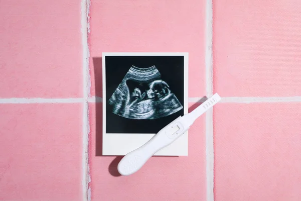 Concept Pregnancy Maternity Top View — Foto de Stock