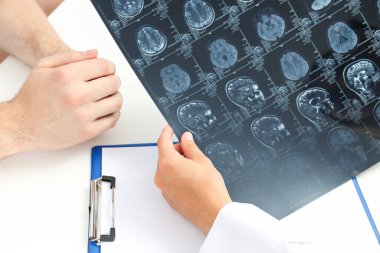 Bir doktorun elinde bir insan kafasının MRI görüntüleri.