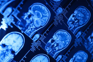 Beyin ve beyin MRI veya manyetik rezonans görüntüleme. Kapat.
