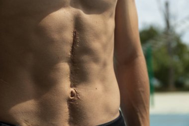 Erkek figürü, karın kasları, güneş ışığı.