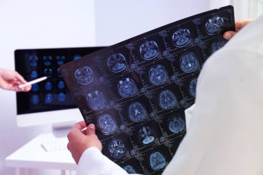 Bir doktorun elinde bir insan kafasının MRI görüntüleri.
