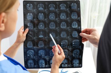 Genç bir kadın doktor insan kafasının MR görüntüsüne bakıyor.