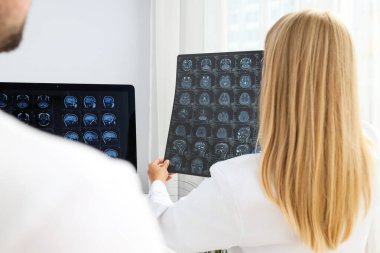 Doktorlar insan kafasının MRI görüntülerine bakıyorlar.