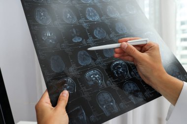 Bir doktorun elinde bir insan kafasının MRI görüntüleri.