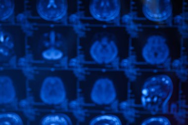 Beyin ve beyin MRI veya manyetik rezonans görüntüleme. Kapat.