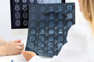 Genç bir kadın doktor insan kafasının MR görüntüsüne bakıyor.