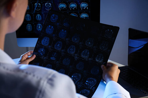 A young female doctor is looking at an MRI image of a human head