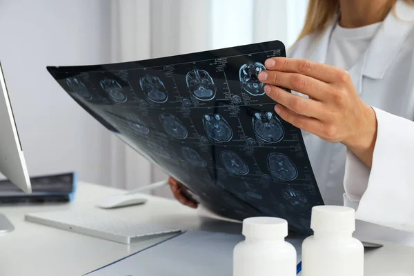 Young Female Doctor Looking Mri Image Human Head — Stock Photo, Image