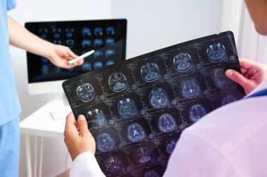 Doktorlar insan kafasının MRI görüntülerine bakıyorlar.