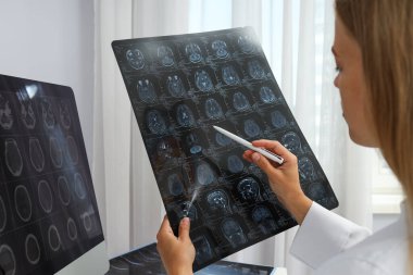 Genç bir kadın doktor insan kafasının MR görüntüsüne bakıyor.