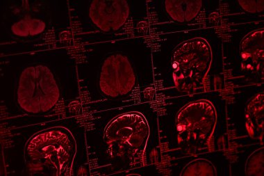 MR veya beyin ve kafanın kırmızı ışıkta manyetik rezonans görüntülemesi. Yakın plan.