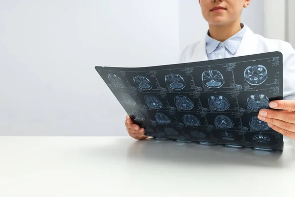 Mri Images Human Head Hands Doctor — Stock Photo, Image